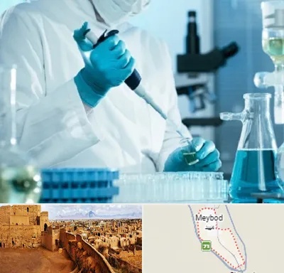 آزمایشگاه HIV در میبد