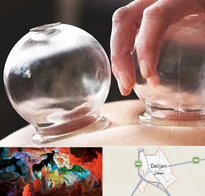 مرکز حجامت در دلیجان