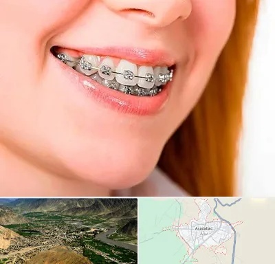 ارتودنسی ارزان در اسدآباد