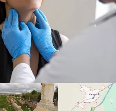 دکتر سرطان گلو در کنگاور