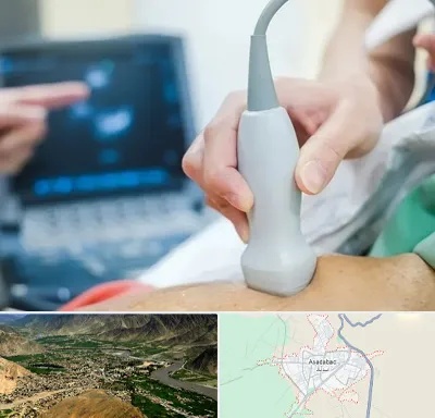 اکو قلب شبانه روزی در اسدآباد