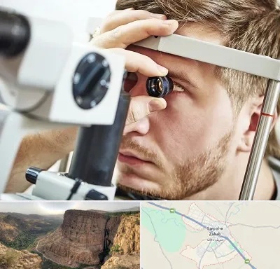 فوق تخصص قرنیه در سرپل ذهاب