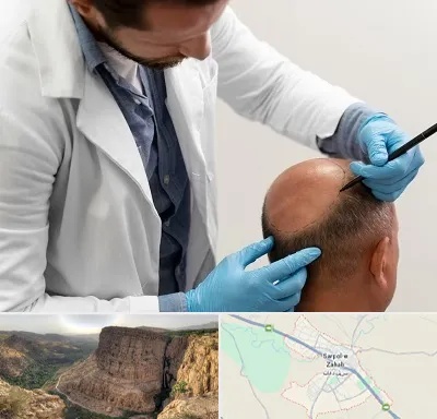کاشت مو به روش تکثیری در سرپل ذهاب