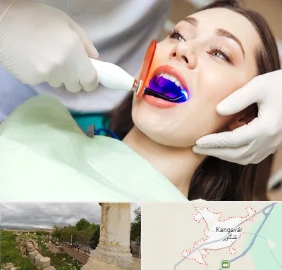 دندانپزشکی بدون درد در کنگاور