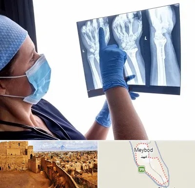 تجهیزات ارتوپدی در میبد