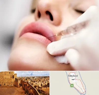 کلینیک تزریق ژل لب در میبد