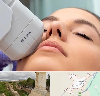 هایفوتراپی در کنگاور