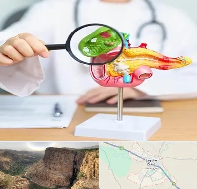 جراح سرطان پانکراس در سرپل ذهاب