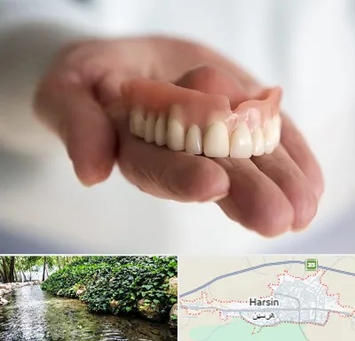 لیفت لثه با لیزر در هرسین