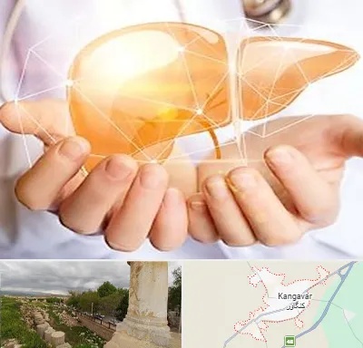دکتر سرطان کبد در کنگاور