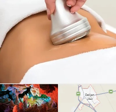 دستگاه لاغری در دلیجان