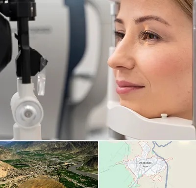 دکتر فوق تخصص چشم در اسدآباد