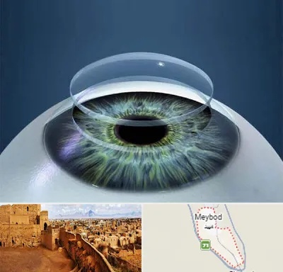 پیوند قرنیه در میبد