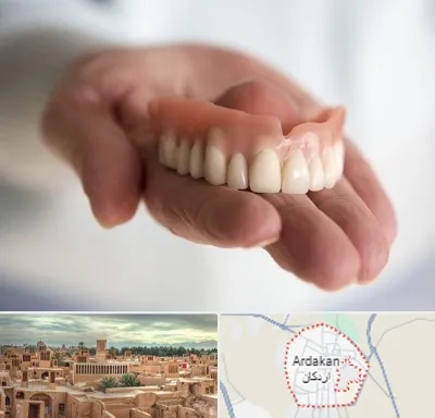 لیفت لثه با لیزر در اردکان