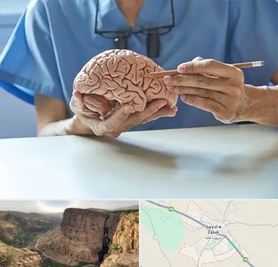 دکتر نورولوژی در سرپل ذهاب