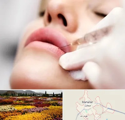 کلینیک تزریق ژل لب در محلات