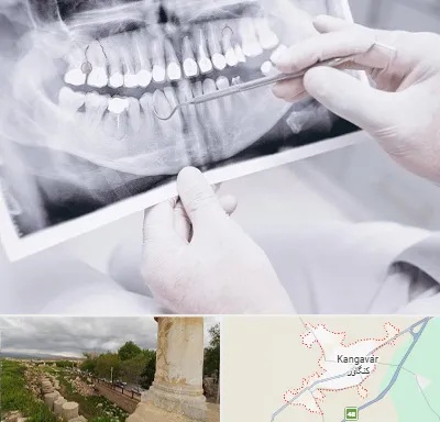 رادیولوژی دهان و دندان در کنگاور