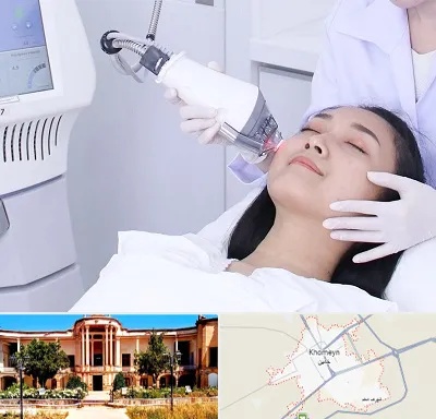 وایتنینگ در خمین