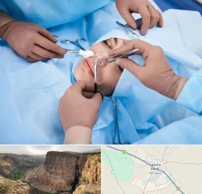 عمل بینی فانتزی در سرپل ذهاب