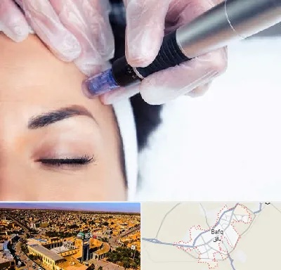 کلینیک مزوتراپی صورت در بافق