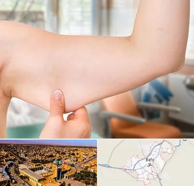 براکیوپلاستی در بافق