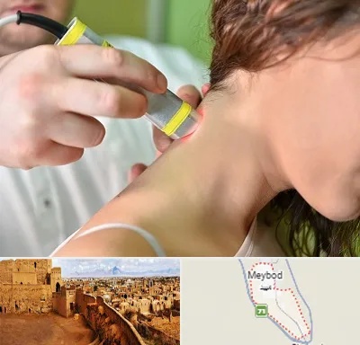 لیزر درمانی در میبد