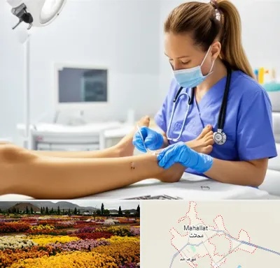 کارشناس زخم در محلات