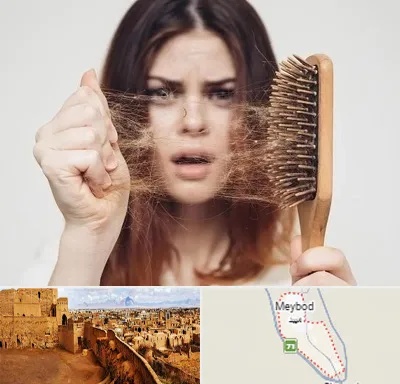 دکتر ریزش مو در میبد
