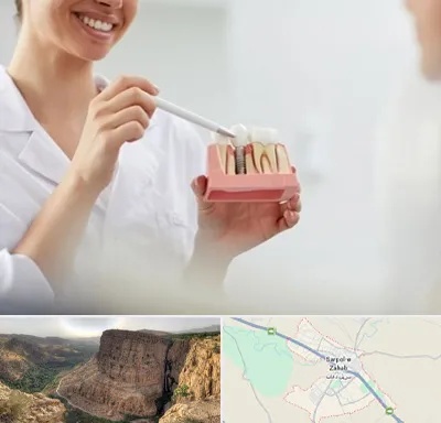 دکتر دندانساز در سرپل ذهاب