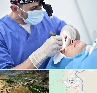 جراح سرطان چشم در اسدآباد
