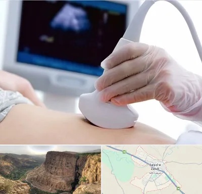 سونوگرافی در سرپل ذهاب