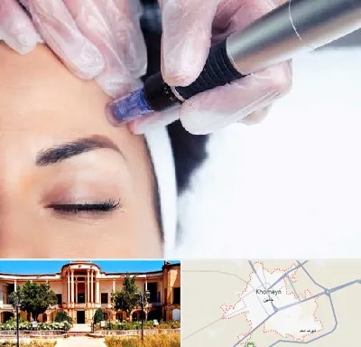 کلینیک مزوتراپی صورت در خمین