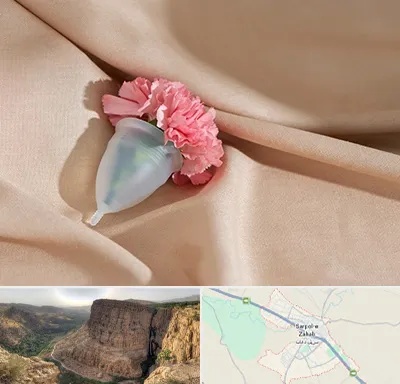 جراح سرطان واژن در سرپل ذهاب