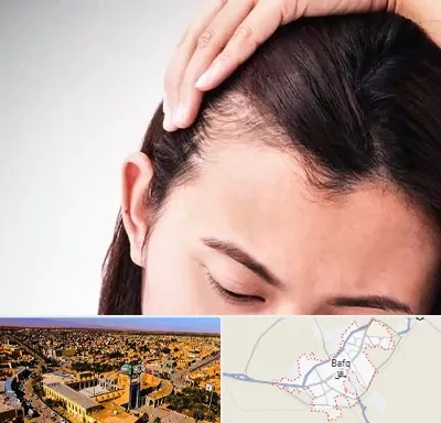 کاشت مو بانوان در بافق