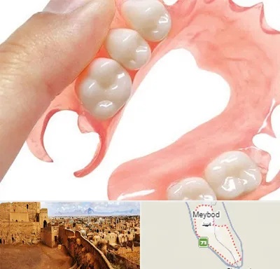 پروتز متحرک دندان در میبد