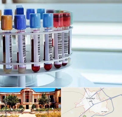 آزمایشگاه ژنتیک در خمین