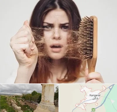 دکتر ریزش مو در کنگاور