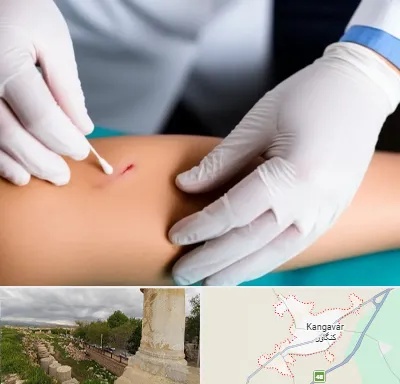 متخصص زخم عفونی در کنگاور