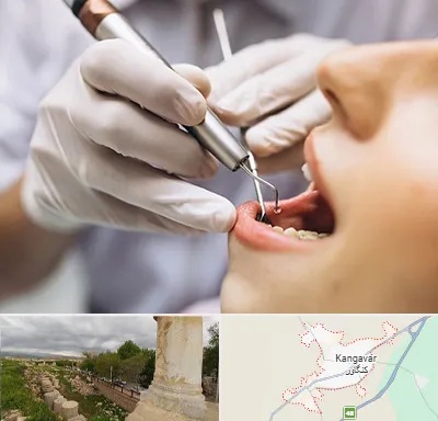 دندانپزشکی ارزان در کنگاور
