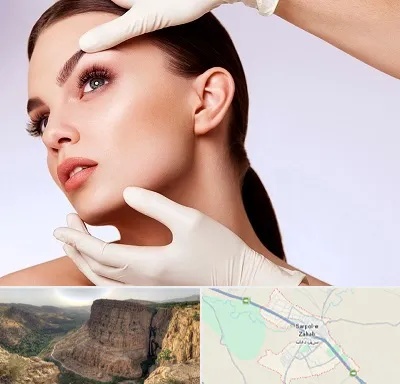 دکتر رفع غبغب در سرپل ذهاب