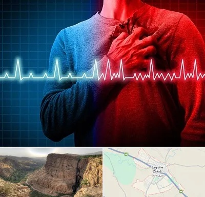 نوار قلب در سرپل ذهاب