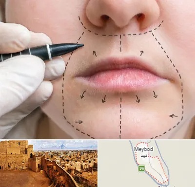 عمل سانترال لب در میبد