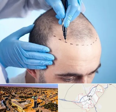 دکتر کاشت مو در بافق