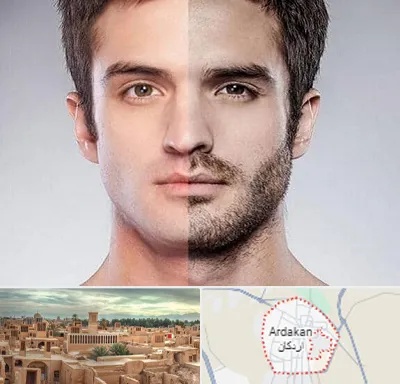 کاشت ریش و سبیل در اردکان
