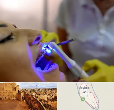 دندانپزشکی با لیزر در میبد