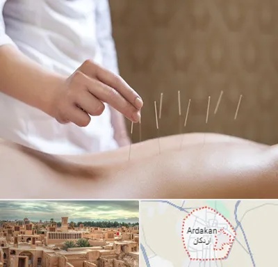 درای نیدلینگ در اردکان