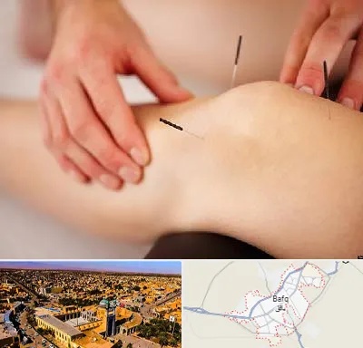 دکتر طب سوزنی برای لاغری در بافق