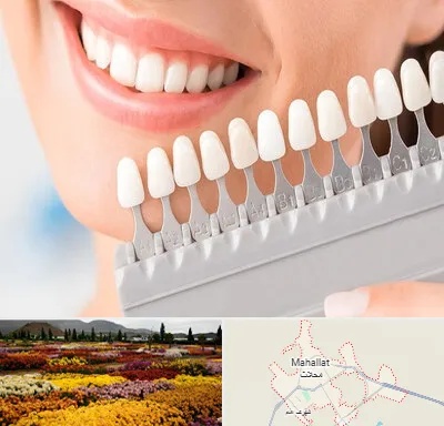 متخصص لمینت دندان در محلات