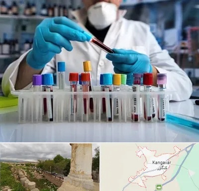 آزمایشگاه خون در کنگاور