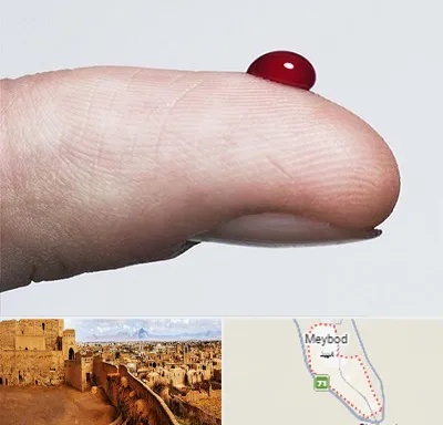 مرکز فصد خون در میبد
